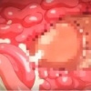Thumbnail of related posts 162